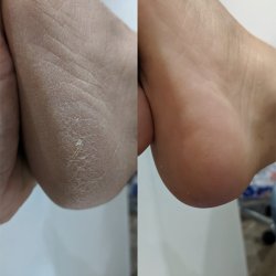 Lova Skin The Essential kit